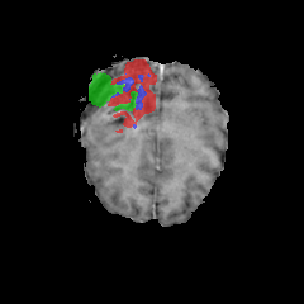 Case 2 Baseline