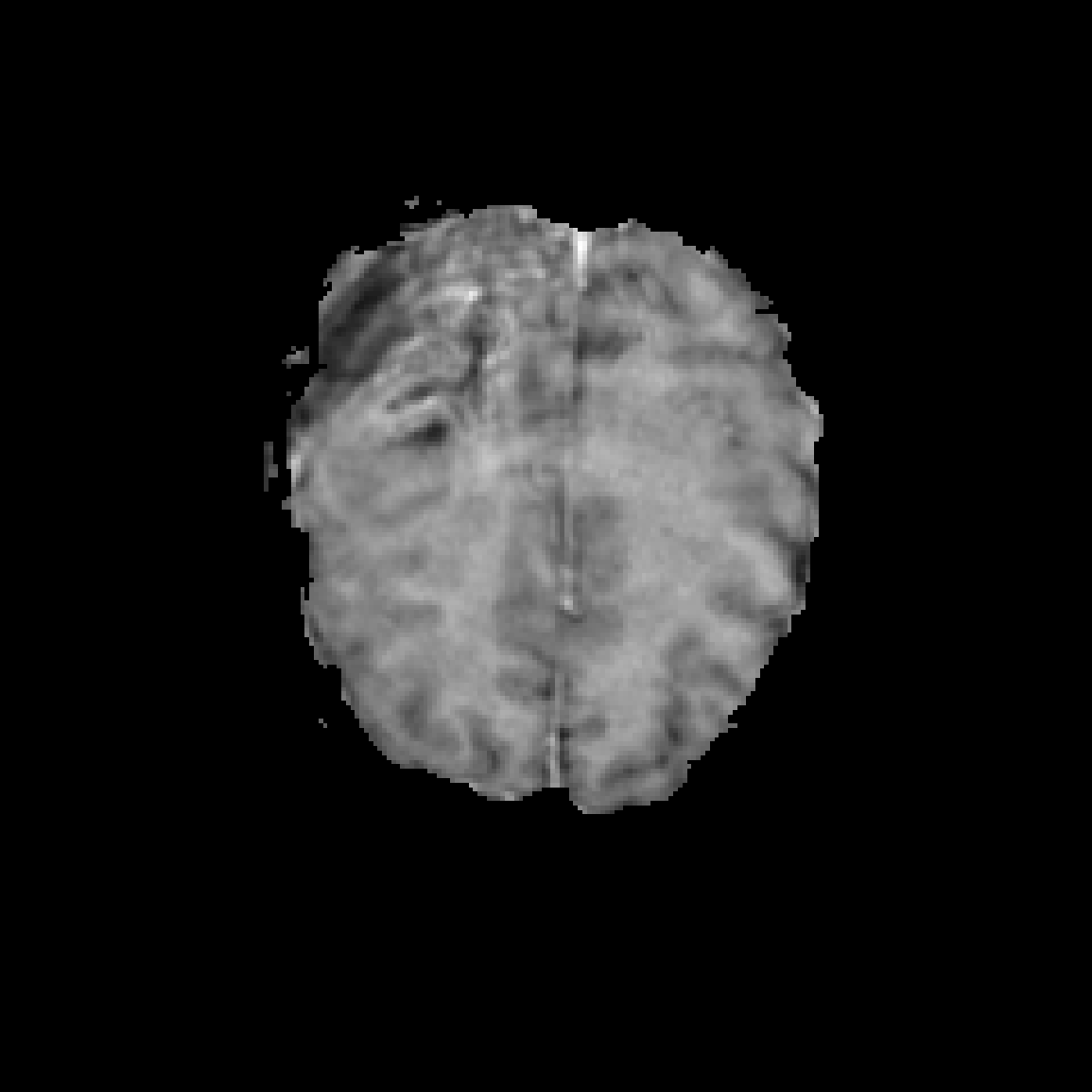 Case 2 T1c