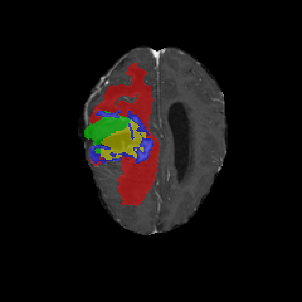 Case 3 Baseline