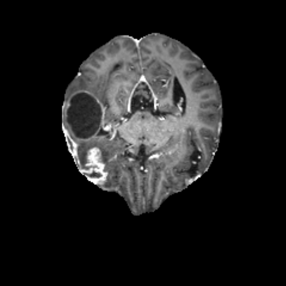 Post-Operative Anatomy