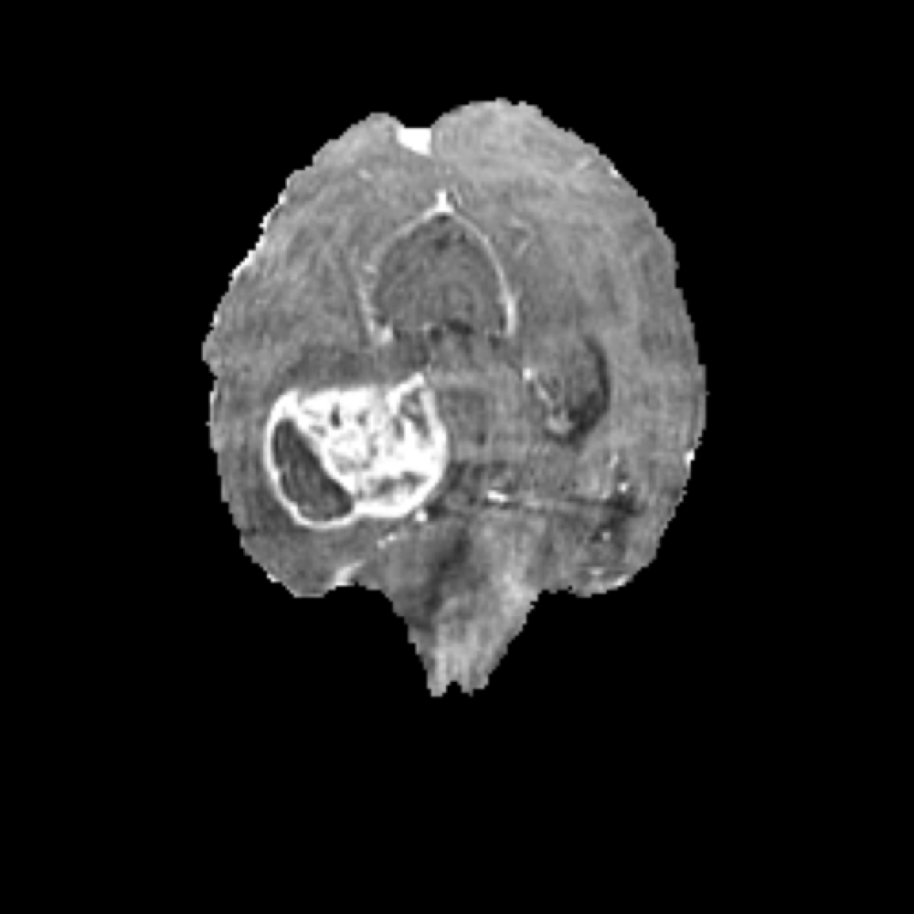 Pre-Operative Anatomy